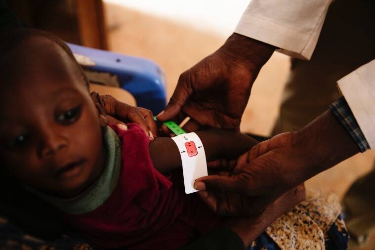 somalia hunger drought africa children