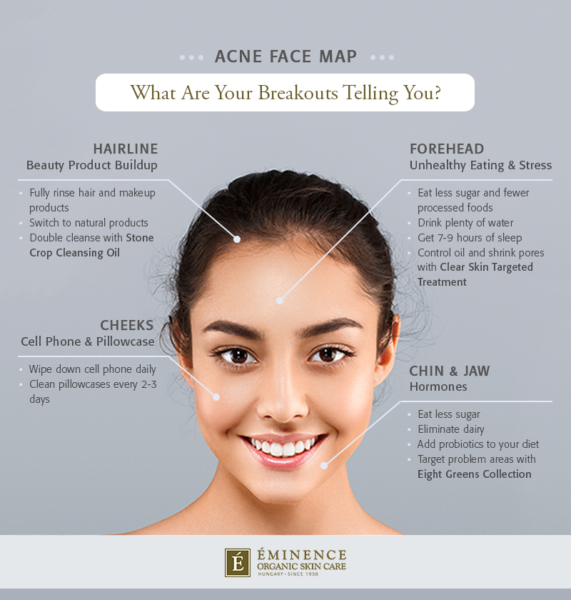 Skin expert shares face map to ‘decode what your breakouts are telling you’